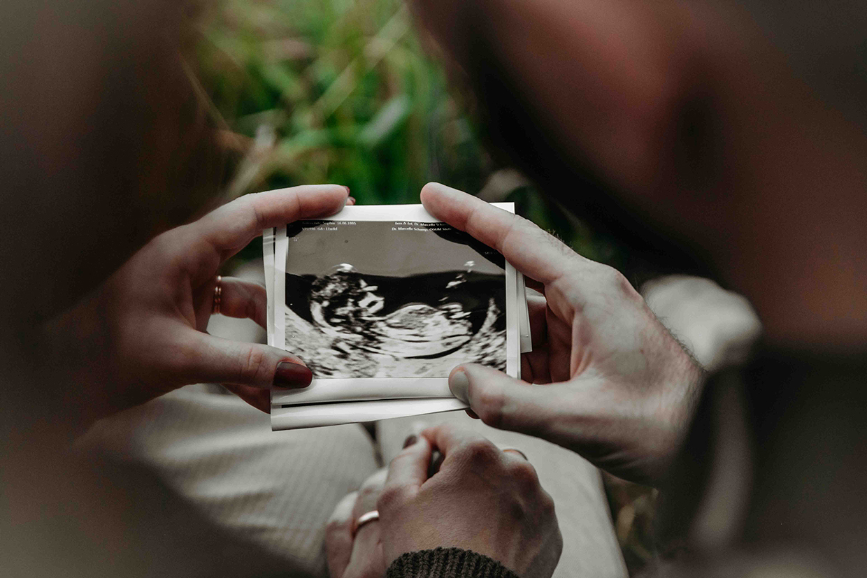 Pärchen, Mann und Frau, halten in ihren Händen ein Ultraschallbild ihren noch nicht geborenen Babys